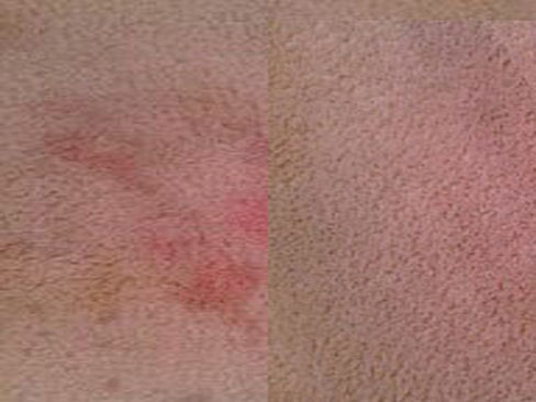 Kool-Aid Stain Before And After Cleaning In Stockbridge GA